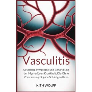 Wolff, Kith Vasculitis: Ursachen, Symptome und Behandlung der mysteriösen Krankheit, die ohne Vorwarnung Organe schädigen kann Wolff, Kith Vasculitis: Ursachen, Symptome und Behandlung der mysteriösen Krankheit, die ohne Vorwarnung Organe schädigen kann