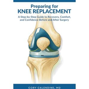 Calendine MD, Cory Preparing for Knee Replacement: Your Complete Guide to Faster Recovery, Better Outcomes, and Confident Healing Calendine MD, Cory Preparing for Knee Replacement: Your Complete Guide to Faster Recovery, Better Outcomes, and Confident Healing