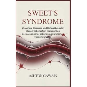 Ashton Sweet’s Syndrome: Ursachen, Diagnose und Behandlung der akuten fieberhaften neutrophilen Dermatose, einer seltenen entzündlichen Hauterkrankung Ashton Sweet’s Syndrome: Ursachen, Diagnose und Behandlung der akuten fieberhaften neutrophilen Dermatose, einer seltenen entzündlichen Hauterkrankung