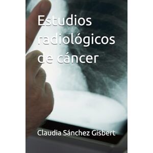 Sánchez Gisbert, Claudia Estudios radiológicos de cáncer Sánchez Gisbert, Claudia Estudios radiológicos de cáncer
