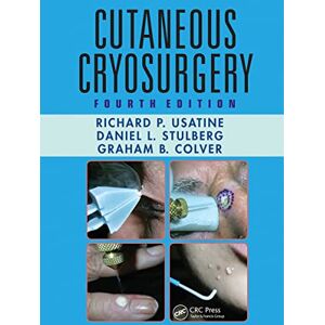 Stulberg, Daniel L. Cutaneous Cryosurgery: Principles and Clinical Practice Stulberg, Daniel L. Cutaneous Cryosurgery: Principles and Clinical Practice