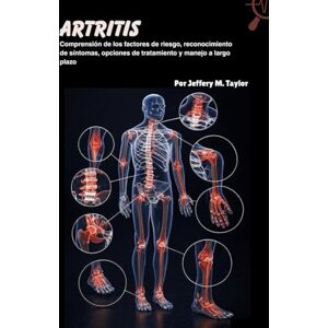 Taylor Artritis: Comprensión de los factores de riesgo, reconocimiento de síntomas, opciones de tratamiento y manejo a largo plazo Taylor Artritis: Comprensión de los factores de riesgo, reconocimiento de síntomas, opciones de tratamiento y manejo a largo plazo