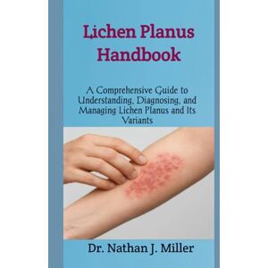 J. Miller, Dr. Nathan Lichen Planus Handbook: A Comprehensive Guide to Understanding, Diagnosing, and Managing Lichen Planus and Its Variants J. Miller, Dr. Nathan Lichen Planus Handbook: A Comprehensive Guide to Understanding, Diagnosing, and Managing Lichen Planus and Its Variants