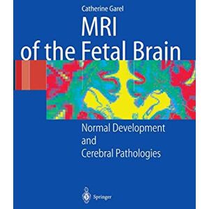 Garel, C. MRI of the Fetal Brain: Normal Development and Cerebral Pathologies Garel, C. MRI of the Fetal Brain: Normal Development and Cerebral Pathologies