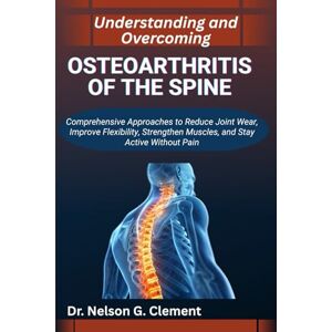 G. Clement, Dr. Nelson UNDERSTANDING AND OVERCOMING OSTEOARTHRITIS OF THE SPINE: Comprehensive Approaches to Reduce Joint Wear, Improve Flexibility, Strengthen Muscles, and Stay Active without Pain G. Clement, Dr. Nelson UNDERSTANDING AND OVERCOMING OSTEOARTHRITIS OF THE SPINE: Comprehensive Approaches to Reduce Joint Wear, Improve Flexibility, Strengthen Muscles, and Stay Active without Pain