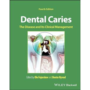 Dental Caries: The Disease and its Clinical Management Dental Caries: The Disease and its Clinical Management