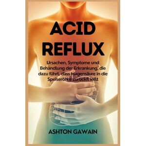 Ashton Acid Reflux: Ursachen, Symptome und Behandlung der Erkrankung, die dazu führt, dass Magensäure in die Speiseröhre zurückfl ießt Ashton Acid Reflux: Ursachen, Symptome und Behandlung der Erkrankung, die dazu führt, dass Magensäure in die Speiseröhre zurückfl ießt