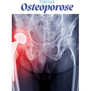 Pflegeleicht, Nadine Osteoporose kompakt für Pflegekräfte – das kleine Kittelbuch: Alles, was Auszubildende wissen müssen – einfach, verständlich, prüfungsrelevant („Kompaktwissen Pflege – Die Kittelbuch-Reihe“) Pflegeleicht, Nadine Osteoporose kompakt für Pflegekräfte – das kleine Kittelbuch: Alles, was Auszubildende wissen müssen – einfach, verständlich, prüfungsrelevant („Kompaktwissen Pflege – Die Kittelbuch-Reihe“)