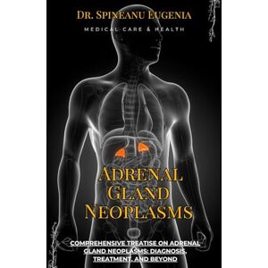 Eugenia, Dr. Spineanu Comprehensive Treatise on Adrenal Gland Neoplasms: Diagnosis, Treatment, and Beyond (Medical care and health) Eugenia, Dr. Spineanu Comprehensive Treatise on Adrenal Gland Neoplasms: Diagnosis, Treatment, and Beyond (Medical care and health)