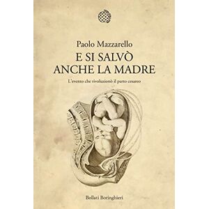 Mazzarello, Paolo E si salvò anche la madre. L'evento che rivoluzionò il parto cesareo Mazzarello, Paolo E si salvò anche la madre. L'evento che rivoluzionò il parto cesareo