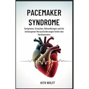 Wolff, Kith Pacemaker Syndrome: Symptome, Ursachen, Behandlungen und die verborgenen Herausforderungen hinter den Herzkammern Wolff, Kith Pacemaker Syndrome: Symptome, Ursachen, Behandlungen und die verborgenen Herausforderungen hinter den Herzkammern