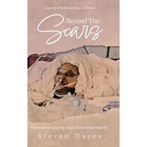 Hayes, Steven Beyond The Scars: A Journey of Resilience, Hope, and Power Hayes, Steven Beyond The Scars: A Journey of Resilience, Hope, and Power