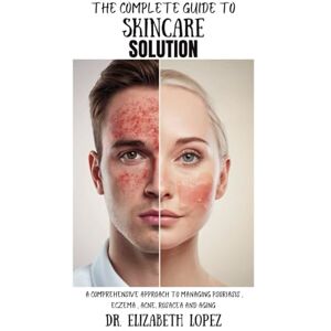 Lopez, Elizabeth THE COMPLETE GUIDE TO SKINCARE SOLUTION: A Comprehensive Approach To Managing Psoriasis, Eczema, Acne, Rosacea and Aging Lopez, Elizabeth THE COMPLETE GUIDE TO SKINCARE SOLUTION: A Comprehensive Approach To Managing Psoriasis, Eczema, Acne, Rosacea and Aging
