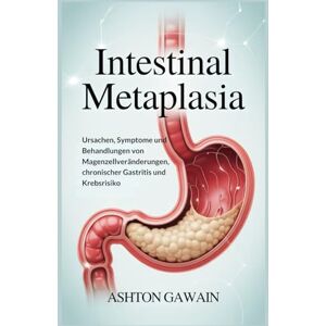 Ashton Intestinal Metaplasia: Ursachen, Symptome und Behandlungen von Magenzellveränderungen, chronischer Gastritis und Krebsrisiko Ashton Intestinal Metaplasia: Ursachen, Symptome und Behandlungen von Magenzellveränderungen, chronischer Gastritis und Krebsrisiko