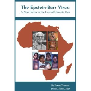 Tennant DrPH, MPH, MD, Forest The Epstein-Barr Virus:: A New Factor in the Care of Chronic Pain Tennant DrPH, MPH, MD, Forest The Epstein-Barr Virus:: A New Factor in the Care of Chronic Pain
