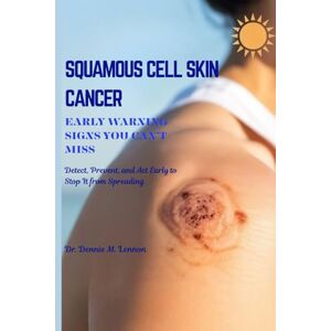 Lennon, Dr. Dennis M. SQUAMOUS CELL SKIN CANCER EARLY WARNING SIGNS YOU CAN’T MISS: Detect, Prevent, and Act Early to Stop It from Spreading Lennon, Dr. Dennis M. SQUAMOUS CELL SKIN CANCER EARLY WARNING SIGNS YOU CAN’T MISS: Detect, Prevent, and Act Early to Stop It from Spreading