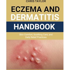 Taylor ECZEMA & DERMATITIS HANDBOOK: Skin Comfort, Soothing Care, and Daily Relief Practices Taylor ECZEMA & DERMATITIS HANDBOOK: Skin Comfort, Soothing Care, and Daily Relief Practices
