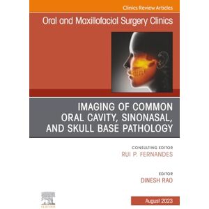 Imaging of Common Oral Cavity, Sinonasal, and Skull Base Pathology, An Issue of Oral and Maxillofacial Surgery Clinics of North America: Volume 35-3 (The Clinics: Dentistry, Volume 35-3) Imaging of Common Oral Cavity, Sinonasal, and Skull Base Pathology, An Issue of Oral and Maxillofacial Surgery Clinics of North America: Volume 35-3 (The Clinics: Dentistry, Volume 35-3)