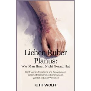 Wolff, Kith Lichen ruber planus: Was man Ihnen nicht gesagt hat: Die Ursachen, Symptome und Auswirkungen dieser oft übersehenen Erkrankung im wirklichen Leben verstehen Wolff, Kith Lichen ruber planus: Was man Ihnen nicht gesagt hat: Die Ursachen, Symptome und Auswirkungen dieser oft übersehenen Erkrankung im wirklichen Leben verstehen