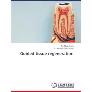 Anish, Dr Maria Guided tissue regeneration Anish, Dr Maria Guided tissue regeneration