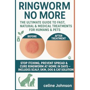 Johnson, Celine Ringworm No More: The Ultimate Guide to Fast, Natural & Medical Treatments for Humans & Pets": Stop Itching, Prevent Spread & Cure Ringworm at Home in ... – Includes Scalp, Skin, Dog & Cat Solutions"* Johnson, Celine Ringworm No More: The Ultimate Guide to Fast, Natural & Medical Treatments for Humans & Pets": Stop Itching, Prevent Spread & Cure Ringworm at Home in ... – Includes Scalp, Skin, Dog & Cat Solutions"*