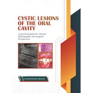 Dr Deivanayagi M Cystic Lesions of the Oral Cavity: A Practical Guide for Clinical, Radiographic and Surgical Perspectives Dr Deivanayagi M Cystic Lesions of the Oral Cavity: A Practical Guide for Clinical, Radiographic and Surgical Perspectives