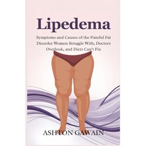 Ashton Lipedema: Symptoms and Causes of the Painful Fat Disorder Women Struggle With, Doctors Overlook, and Diets Can’t Fix Ashton Lipedema: Symptoms and Causes of the Painful Fat Disorder Women Struggle With, Doctors Overlook, and Diets Can’t Fix