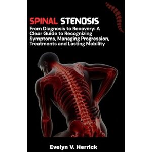 V. Herrick, Evelyn Spinal Stenosis: From Diagnosis to Recovery: A Clear Guide to Recognizing Symptoms, Managing Progression, Treatments and Lasting Mobility. V. Herrick, Evelyn Spinal Stenosis: From Diagnosis to Recovery: A Clear Guide to Recognizing Symptoms, Managing Progression, Treatments and Lasting Mobility.