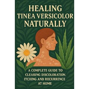 Anderson, Lucie Healing Tinea Versicolor Naturally: A Complete Guide to Clearing Discoloration, Itching and Recurrence at Home Anderson, Lucie Healing Tinea Versicolor Naturally: A Complete Guide to Clearing Discoloration, Itching and Recurrence at Home