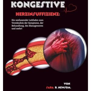 R. Newsom, Sara Kongestive Herzinsuffizienz: Ein umfassender Leitfaden zum Verständnis der Symptome, der Behandlung, des Managements und mehr! R. Newsom, Sara Kongestive Herzinsuffizienz: Ein umfassender Leitfaden zum Verständnis der Symptome, der Behandlung, des Managements und mehr!