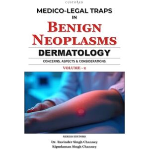 CHANNEY Delhi, DR. RAVINDER SINGH Medico-Legal Traps in Benign Neoplasms Dermatology Vol 2 (MEDICO-LEGAL SERIES) CHANNEY Delhi, DR. RAVINDER SINGH Medico-Legal Traps in Benign Neoplasms Dermatology Vol 2 (MEDICO-LEGAL SERIES)