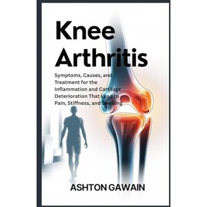 Ashton Knee Arthritis: Symptoms, Causes, and Treatment for the Infl ammation and Cartilage Deterioration That Lead to Pain, Stiffness, and Swelling Ashton Knee Arthritis: Symptoms, Causes, and Treatment for the Infl ammation and Cartilage Deterioration That Lead to Pain, Stiffness, and Swelling