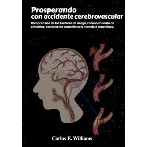 E. Williams, Carlos Prosperando con accidente cerebrovascular: Comprensión de los factores de riesgo, reconocimiento de síntomas, opciones de tratamiento y manejo a largo plazo. E. Williams, Carlos Prosperando con accidente cerebrovascular: Comprensión de los factores de riesgo, reconocimiento de síntomas, opciones de tratamiento y manejo a largo plazo.