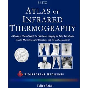 Reitz, Felipe ATLAS OF INFRARED THERMOGRAPHY: A Practical Clinical Guide: Functional Imaging for Pain, Circulatory Health, Musculoskeletal Disorders, and Visceral Assessment Reitz, Felipe ATLAS OF INFRARED THERMOGRAPHY: A Practical Clinical Guide: Functional Imaging for Pain, Circulatory Health, Musculoskeletal Disorders, and Visceral Assessment