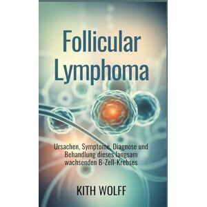 Wolff, Kith Follicular Lymphoma: Ursachen, Symptome, Diagnose und Behandlung dieses langsam wachsenden B-Zell-Krebses Wolff, Kith Follicular Lymphoma: Ursachen, Symptome, Diagnose und Behandlung dieses langsam wachsenden B-Zell-Krebses