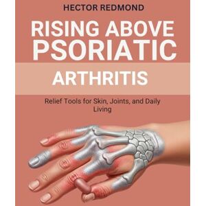 Redmond, Hector Rising Above Psoriatic Arthritis: Relief Tools for Skin, Joints, and Daily Living Redmond, Hector Rising Above Psoriatic Arthritis: Relief Tools for Skin, Joints, and Daily Living