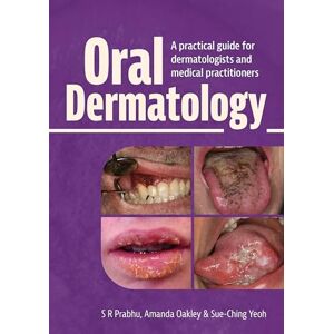 Prabhu, S.R. Oral Dermatology: A practical guide for dermatologists and medical practitioners Prabhu, S.R. Oral Dermatology: A practical guide for dermatologists and medical practitioners