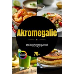 GUT, NUTRALYSE Akromegalie: Wie du mit stoffwechselgerechter Ernährung deine Symptome reduzierst und dich wohler fühlst inkl. Tagebuch GUT, NUTRALYSE Akromegalie: Wie du mit stoffwechselgerechter Ernährung deine Symptome reduzierst und dich wohler fühlst inkl. Tagebuch