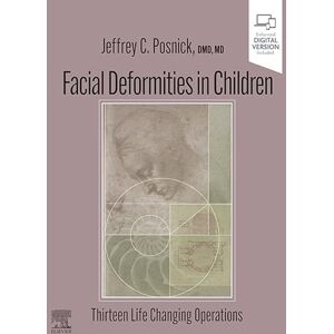 Elsevier Facial Deformities in Children E-Book Elsevier Facial Deformities in Children E-Book