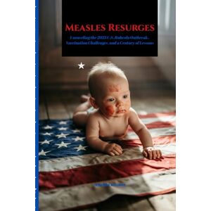 McClurkin, Cassandra Measles Resurges: Unraveling the 2025 U.S. Rubeola Outbreak, Vaccination Challenges, and a Century of Lessons (Remedies for Health Complications Series) McClurkin, Cassandra Measles Resurges: Unraveling the 2025 U.S. Rubeola Outbreak, Vaccination Challenges, and a Century of Lessons (Remedies for Health Complications Series)