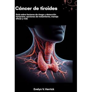 V. Herrick, Evelyn Cáncer de tiroides: Guía sobre factores de riesgo y detección temprana, opciones de tratamiento, manejo eficaz y más V. Herrick, Evelyn Cáncer de tiroides: Guía sobre factores de riesgo y detección temprana, opciones de tratamiento, manejo eficaz y más