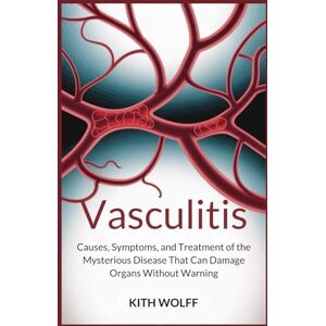 Wolff, Kith Vasculitis: Causes, Symptoms, and Treatment of the Mysterious Disease That Can Damage Organs Without Warning Wolff, Kith Vasculitis: Causes, Symptoms, and Treatment of the Mysterious Disease That Can Damage Organs Without Warning