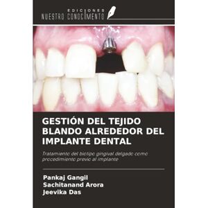 Gangil, Pankaj GESTIÓN DEL TEJIDO BLANDO ALREDEDOR DEL IMPLANTE DENTAL: Tratamiento del biotipo gingival delgado como procedimiento previo al implante Gangil, Pankaj GESTIÓN DEL TEJIDO BLANDO ALREDEDOR DEL IMPLANTE DENTAL: Tratamiento del biotipo gingival delgado como procedimiento previo al implante