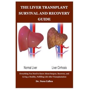 Callen, Dr. Nora THE LIVER TRANSPLANT SURVIVAL AND RECOVERY GUIDE: Everything You Need to Know About Surgery, Recovery, and Living a Healthy, Fulfilling Life After Transplantation Callen, Dr. Nora THE LIVER TRANSPLANT SURVIVAL AND RECOVERY GUIDE: Everything You Need to Know About Surgery, Recovery, and Living a Healthy, Fulfilling Life After Transplantation