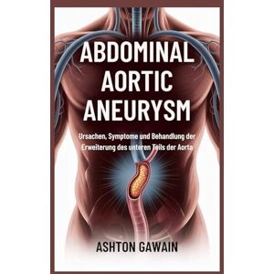 Ashton Abdominal Aortic Aneurysm: Ursachen, Symptome und Behandlung der Erweiterung des unteren Teils der Aorta Ashton Abdominal Aortic Aneurysm: Ursachen, Symptome und Behandlung der Erweiterung des unteren Teils der Aorta