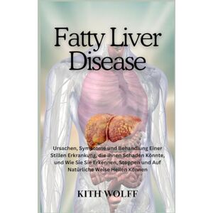 Wolff, Kith Fatty Liver Disease: Ursachen, Symptome und Behandlung einer stillen Erkrankung, die Ihnen schaden könnte, und wie Sie sie erkennen, stoppen und auf natürliche Weise heilen können Wolff, Kith Fatty Liver Disease: Ursachen, Symptome und Behandlung einer stillen Erkrankung, die Ihnen schaden könnte, und wie Sie sie erkennen, stoppen und auf natürliche Weise heilen können