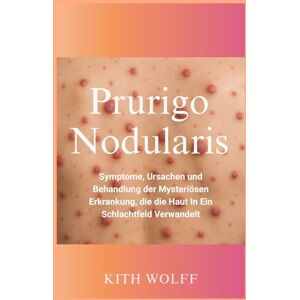 Wolff, Kith Prurigo Nodularis: Symptome, Ursachen und Behandlung der mysteriösen Erkrankung, die die Haut in ein Schlachtfeld verwandelt Wolff, Kith Prurigo Nodularis: Symptome, Ursachen und Behandlung der mysteriösen Erkrankung, die die Haut in ein Schlachtfeld verwandelt