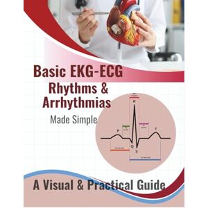 MedEd, SY Basic EKG-ECG, Rhythms & Arrhythmias Made Simple: A Beginner-Friendly Visual Guide to Understanding Heart Rhythms, Arrhythmias, and ECG Interpretation ... Paramedics, EMTs, and Medical Students MedEd, SY Basic EKG-ECG, Rhythms & Arrhythmias Made Simple: A Beginner-Friendly Visual Guide to Understanding Heart Rhythms, Arrhythmias, and ECG Interpretation ... Paramedics, EMTs, and Medical Students