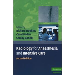 Radiology for Anaesthesia and Intensive Care, Second Edition (Cambridge Medicine (Paperback)) Radiology for Anaesthesia and Intensive Care, Second Edition (Cambridge Medicine (Paperback))