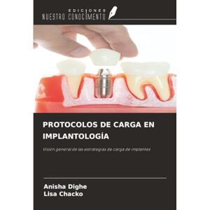 Dighe, Anisha PROTOCOLOS DE CARGA EN IMPLANTOLOGÍA: Visión general de las estrategias de carga de implantes Dighe, Anisha PROTOCOLOS DE CARGA EN IMPLANTOLOGÍA: Visión general de las estrategias de carga de implantes